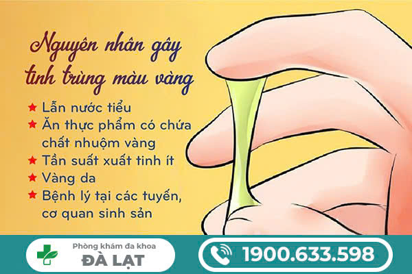 Hình ảnh minh họa